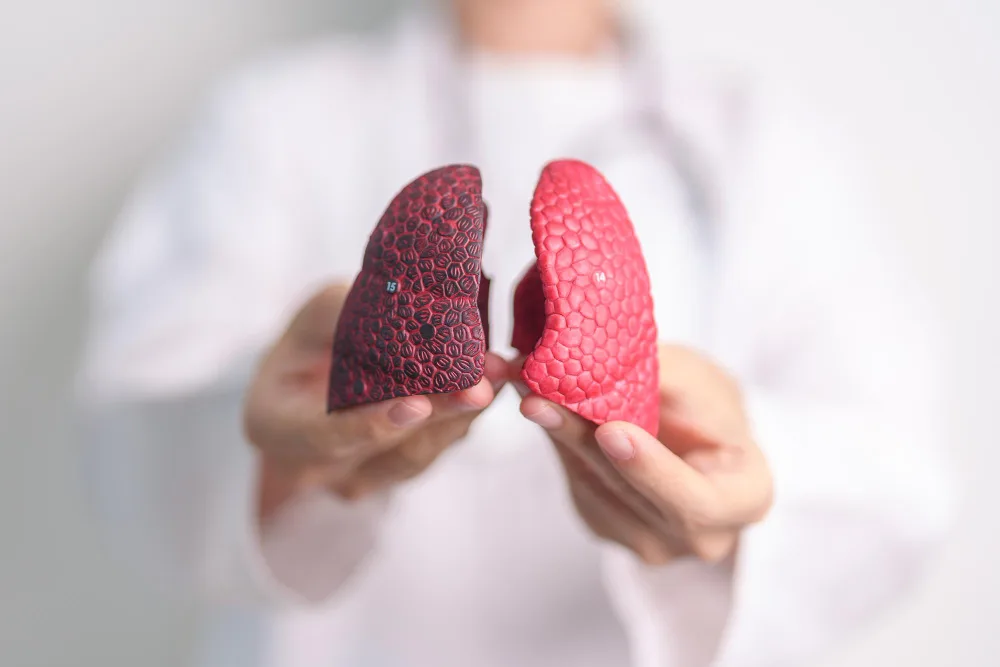 Cáncer pulmonar